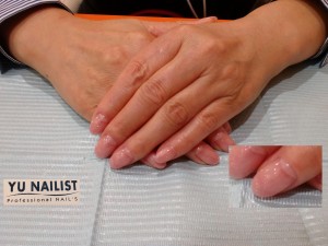 e382b7e383b3e38397e383abe38394e383b3e382afblg1 e382b7e383b3e38397e383abe38394e383b3e382afblg1